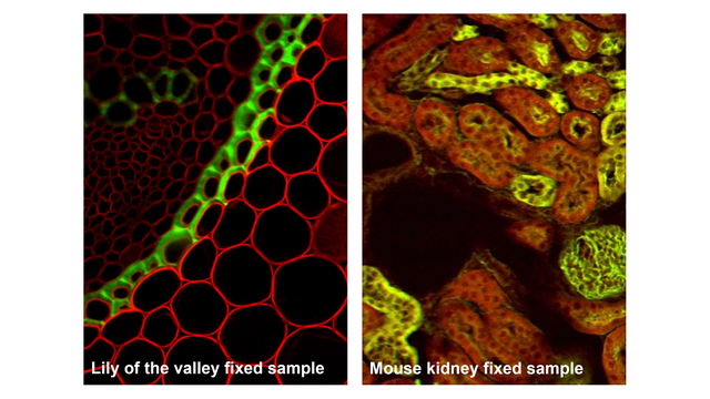 Two-Photon Microscopy